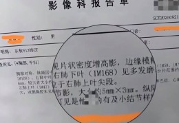 沈阳一医院CT报告单医生写出不雅用词！院方称其打字有误