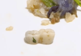 杭州顾客聚餐时吃出两颗牙齿，疑似假牙，商家：我们不知道哪里来的……