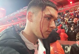 TYC：南美杯智利大学vs阿根廷独立球迷激烈冲突，比赛中断20分钟