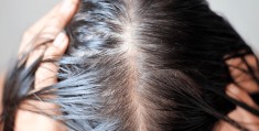 毛利达:脱发焦虑下的头皮护理，是智商税吗？ | 新消费察看
