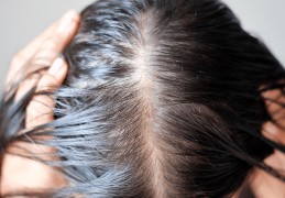 毛利达:脱发焦虑下的头皮护理，是智商税吗？ | 新消费察看